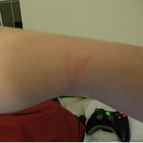 The mark left from the cuffs