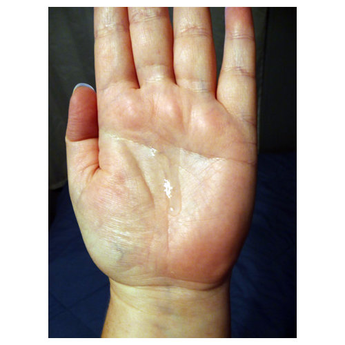 Running down my hand