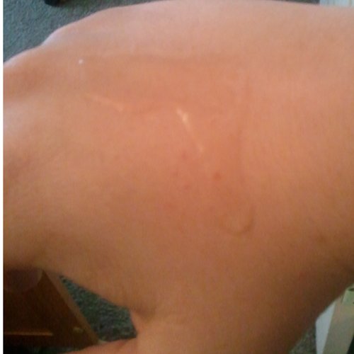 on my hand